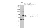 Phospho-STAT3 (Tyr705) Antibody in Western Blot (WB)