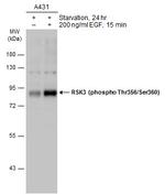 Phospho-RSK3 (Thr356, Ser360) Polyclonal Antibody