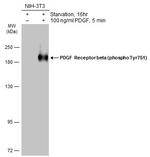 Phospho-PDGFRB (Tyr751) Antibody in Western Blot (WB)
