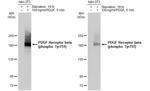 Phospho-PDGFRB (Tyr751) Antibody in Western Blot (WB)