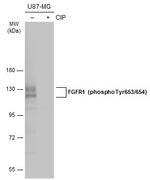 Phospho-FGFR1 (Tyr653, Tyr654) Polyclonal Antibody