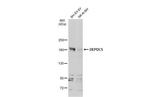 DEPDC5 Polyclonal Antibody