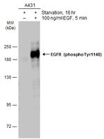 Phospho-EGFR (Tyr1148) Antibody in Western Blot (WB)