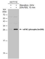 Phospho-eIF4E (Ser209) Antibody in Western Blot (WB)