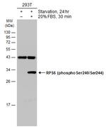 Phospho-S6 (Ser240, Ser244) Antibody in Western Blot (WB)