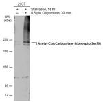 Phospho-Acetyl-CoA Carboxylase (Ser79) Polyclonal Antibody