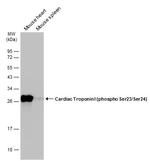 Phospho-Cardiac Troponin I (Ser23, Ser24) Polyclonal Antibody