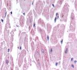 HIF-2 alpha Antibody in Immunohistochemistry (Paraffin) (IHC (P))