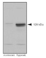 HIF-2 alpha Antibody in Western Blot (WB)