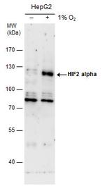 HIF-2 alpha Antibody in Western Blot (WB)