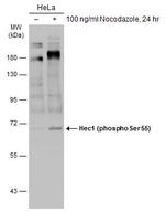 Phospho-HEC1 (Ser55) Antibody in Western Blot (WB)