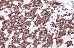 53BP1 Antibody in Immunohistochemistry (Paraffin) (IHC (P))