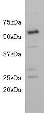CD4 Antibody in Western Blot (WB)