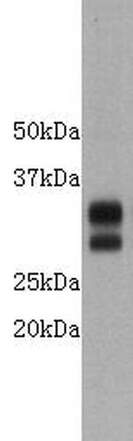 CD8 Antibody in Western Blot (WB)