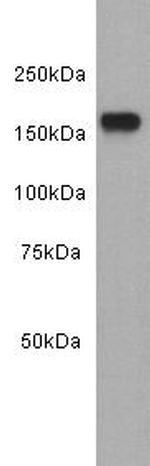 EGFR Antibody in Western Blot (WB)