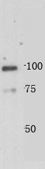 JPH2 Polyclonal Antibody