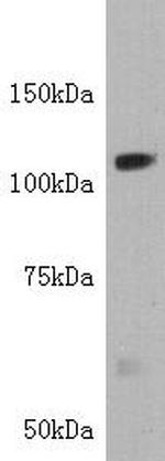 TIE1 Antibody in Western Blot (WB)
