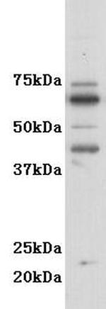 CD116 Polyclonal Antibody
