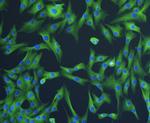 Beta III Tubulin Antibody in Immunocytochemistry (ICC/IF)