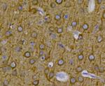 Beta III Tubulin Antibody in Immunohistochemistry (Paraffin) (IHC (P))