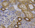 Beta III Tubulin Antibody in Immunohistochemistry (Paraffin) (IHC (P))