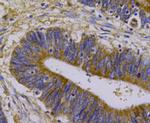Beta III Tubulin Antibody in Immunohistochemistry (Paraffin) (IHC (P))