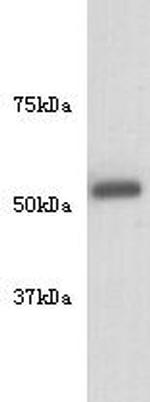 Beta III Tubulin Antibody in Western Blot (WB)