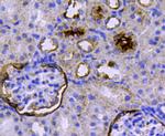 CD10 Antibody in Immunohistochemistry (Paraffin) (IHC (P))