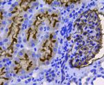 CD10 Antibody in Immunohistochemistry (Paraffin) (IHC (P))