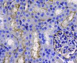 CD10 Antibody in Immunohistochemistry (Paraffin) (IHC (P))