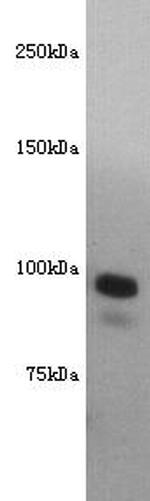 CD10 Antibody in Western Blot (WB)