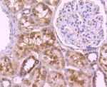 CD171 (L1CAM) Antibody in Immunohistochemistry (Paraffin) (IHC (P))