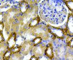 CD171 (L1CAM) Antibody in Immunohistochemistry (Paraffin) (IHC (P))