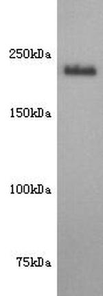 CD171 (L1CAM) Antibody in Western Blot (WB)