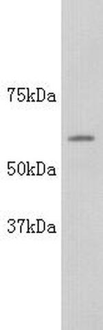 Alkaline Phosphatase (Isoform 4) Polyclonal Antibody