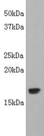 TNF beta Polyclonal Antibody