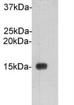 Cystatin C Polyclonal Antibody