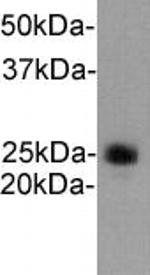 Ly-6G Polyclonal Antibody