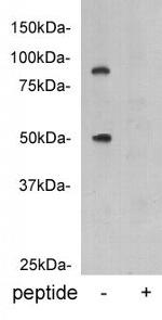 Protein C Polyclonal Antibody