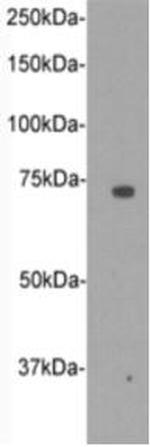 CD105 (Endoglin) Antibody in Western Blot (WB)