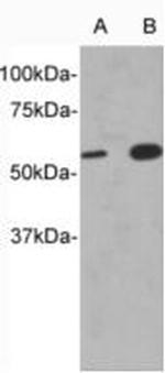 CD213a1 (IL-13Ra1) Polyclonal Antibody