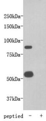 TMEM2 Polyclonal Antibody