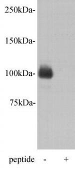 PGBD5 Antibody in Western Blot (WB)