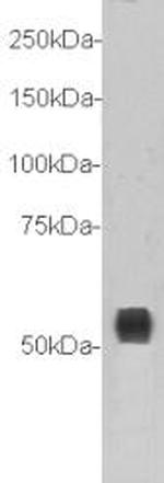 TMEM132A Antibody in Western Blot (WB)