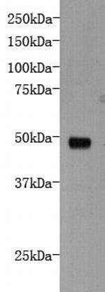 DCHS1 Polyclonal Antibody