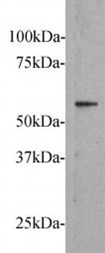 FZD5 Polyclonal Antibody