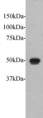 FAT1 Polyclonal Antibody