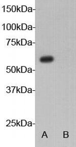 AIRE Antibody in Western Blot (WB)