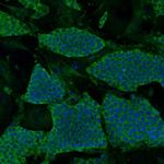 N-cadherin Polyclonal Antibody