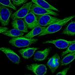 alpha Tubulin Polyclonal Antibody